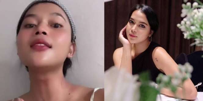 Blak-Blakan Dinda Syarif Ungkap Proses Operasi Jakun, 5 Potret Hasilnya Sekarang