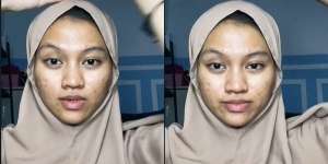 Potret Sebelum dan Sesudah Wanita Berjerawat Dimakeup, Hasilnya Bikin Tercengang!