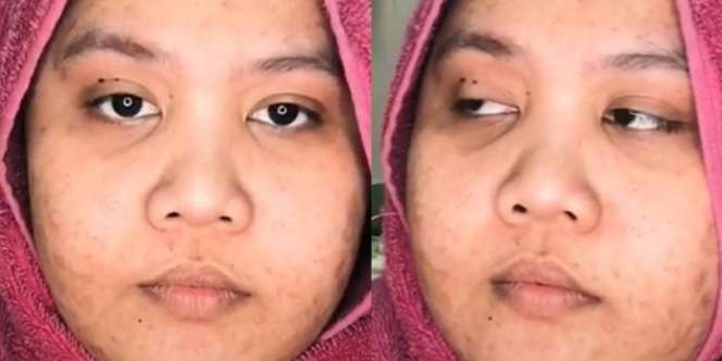 Awalnya Gadis Berwajah Bad Skin, Habis Dirias jadi ‘OMG Bunda’