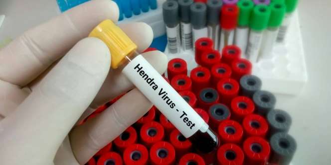 Heboh Kemunculan Virus Hendra di Australia, Begini Penularannya