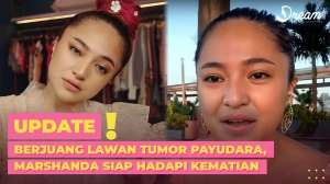 Berjuang Lawan Tumor Payudara, Marshanda Siap Hadapi Kematian