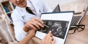 Hukum Islam Gugurkan Kandungan karena Down Syndrome