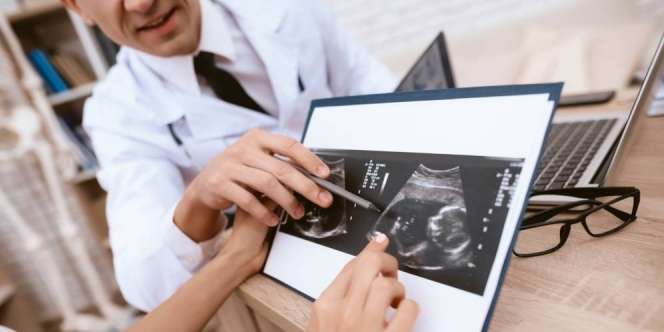 Hukum Islam Gugurkan Kandungan karena Down Syndrome