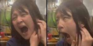 Viral Wanita Cantik Tertawa Ngakak Sampai Rahangnya Keseleo, Mulut Terus Menganga Tak Bisa Ditutup