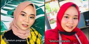 Potret Wanita yang Hamil Alami Kondisi Aneh, Wajah Bengkak dan Keriput Mirip Nenek-Nenek