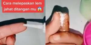 Tips Lepaskan Jari Lengket Kena Lem Super Kuat Ternyata Gampang Sekali, Cuma Pakai Garam dan Air