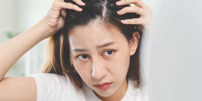Pakai Haircare Terlalu Banyak Bisa Sebabkan Ketombe, Ini Cara Mengatasinya