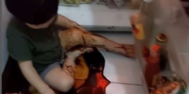 Balita Dikira Tenang Main Sendiri, Ternyata Mandi Kecap