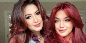 Jarang Terekspos! 5 Potret Cantik Queennara Putri Liza Natalia, Bentuk Bibir Disorot