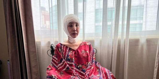 Ngeri! Begini Wajah Lucinta Luna Usai Gergaji Rahang