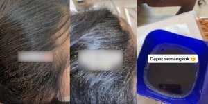 Pemilik Salon Syok Lihat Kutu Rambut Menempel Kayak Butiran Beras, Cuma Disisir Dikit Langsung Dapat Semangkok