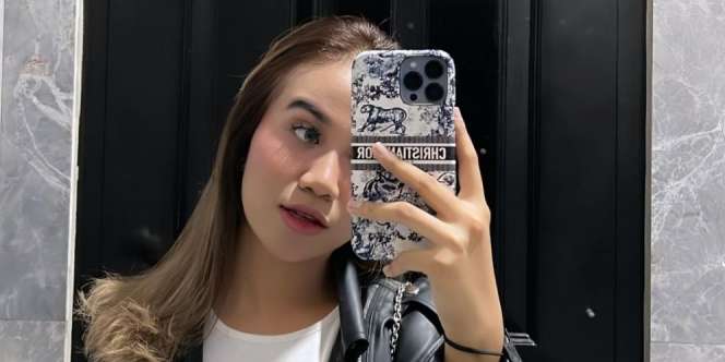 Percantik Diri, Mayang Pakai Behel Biar Muka Simetris dan Body Goals