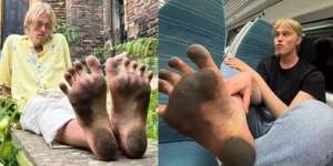 Pria Ini Ingin Kaya dengan Jual Foto Kakinya yang Kotor Usai Setahun Tak Pakai Sepatu