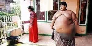 10 Potret Rumah Arya Permana, Bocah Obesitas Viral Dulu 192 Kg, Kini Jadi Gagah & Ganteng!