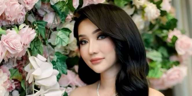 Operasi Plastik, Perubahan Wajah Lucinta Luna Mengejutkan