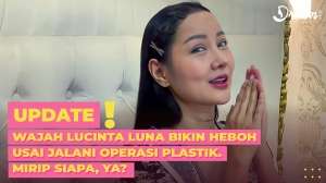 Wajah Lucinta Luna Bikin Heboh usai Jalani Operasi Plastik, Mirip Siapa ya?