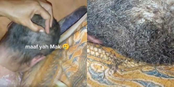 Bikin Ngeri dan Merinding, Kepala Nenek Penuh Kutu Rambut, Cuma Diusap Langsung Rontok Kayak Pasir