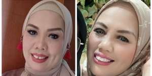 Potret Dulu dan Sekarang Elly Sugigi, Sempat Diduga Oplas Kini Penampilannya Bikin Pangling!