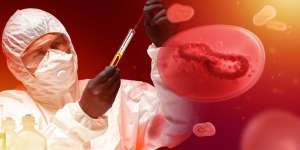 Darurat Cacar Monyet, Kisah Dokter Penemu Kasus Pertama