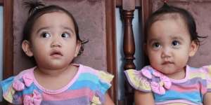 Tumbuh Kembang Anak Kembar Berbeda? Cari Tahu Faktanya