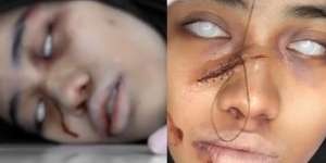 Si Cewek Bikin Konsep Makeup dengan Wajah Dijahit, Lihat Hasilnya Bikin Merinding