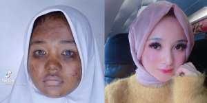 Viral Cewek Berjerawat Minta Dirias MUA Mirip Selebgram Terkenal, Hasilnya Keren Abis!
