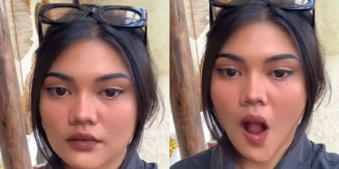 Mengaku Keseringan Pakai Kipas Angin, Separuh Wajah Gadis Ini Lumpuh Akibat Bell's Palsy