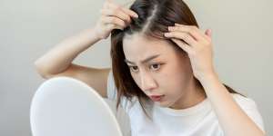 Ikatan Rambut Bisa Sebabkan Kebotakan, Ini Penjelasan Dokter
