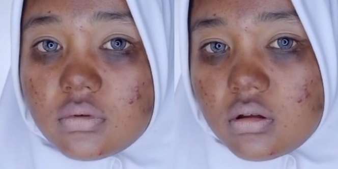 MUA Berhasil Rias Wajah Remaja Ini jadi Mirip Selebgram Herlin Kenza, Berubah 180 Derajat!