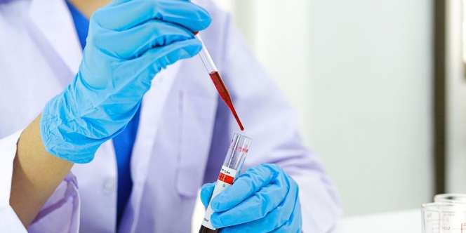 Pasangan Ini Iseng Tes DNA Usai Pacaran 6 Tahun, Syok Tahu Ternyata Saudara Kandung