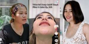 11 Transformasi Farida Nurhan Usai 3 Kali Oplas, Sampai Tak Dikenali, Disebut Mirip Michael Jackson