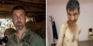 Viral Foto 'Before After' Tentara Ukraina yang Jadi Tawanan Perang Rusia, Sangat Menyedihkan Tinggal Tulang Dibalut Kulit
