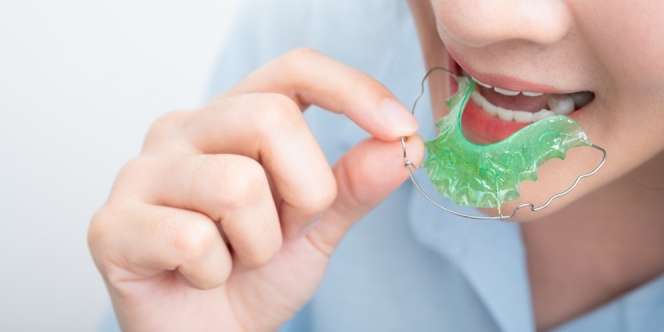 Seberapa Penting Pemakaian Retainer Setelah Melepas Behel atau Aligner?
