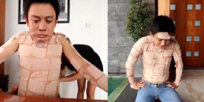 Pemuda Nekat Pasang Koyo Cabe di Sekujur Badan, Sepintas Kaya Pakai Kemeja Berakhir `Kejet-Kejet`