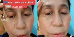 Idap Penyakit Langka, Wajah Wanita 28 Tahun Ini Berubah Seperti Wanita Usia 60 Tahunan