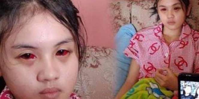 Perjuangan Cahyu Nur Dewata Kembalikan Ingatan yang Hilang Usai Koma Akibat Tragedi Kanjuruhan