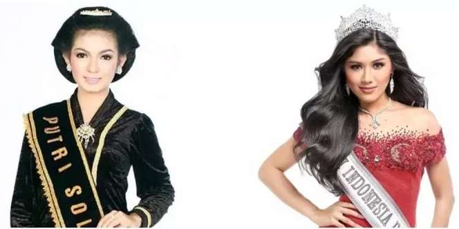 Adu Gaya Selvi Ananda dan Erina Gudono, Sama-sama Pernah Jadi Putri Kecantikan!