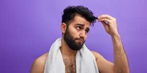 Vincent Rompies dan 1,2 Miliar Cowok di Dunia Hadapi Masalah Kebotakan