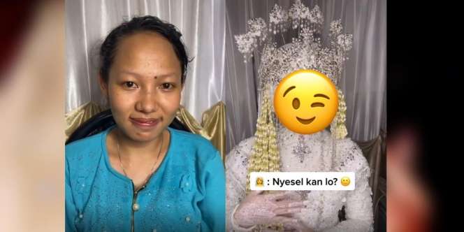 Transformasi Before-After Wanita Ini Bikin Mantan yang Dulu Kabur Meninggalkannya Auto Menyesal, Kayak Beda Orang
