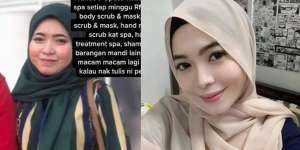 Ingat Wanita Berjerawat yang Dimodali Pacar Rp6,5 Juta Perminggu Agar Cantik? Begini Nasibnya Sekarang
