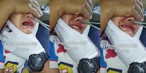 Orang Tua Panik Lihat Hidung Bocah Terselip Biji Kacang, Netizen Minim Empati Malah Nostalgia Masa Kecil