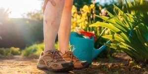 Perempuan Lebih Berisiko Terkena Varises, Ini Alasannya