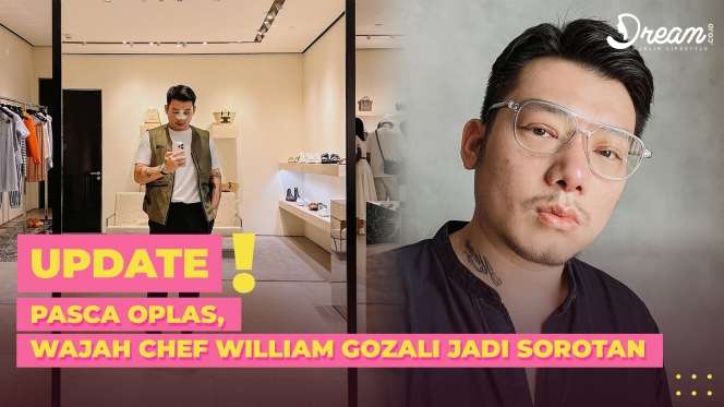 Pasca Oplas, Wajah Chef William Gozali Jadi Sorotan