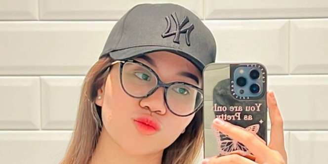 Begini Penampkan Hidung Mayang Setelah Oplas Rp20 Juta