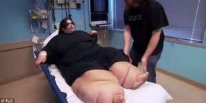 Masih Ingat Wanita Paling Gendut di Dunia dengan Bobot 317 Kg? Dulu Dijuluki Monster, Kini Perubahannya Bikin Pangling