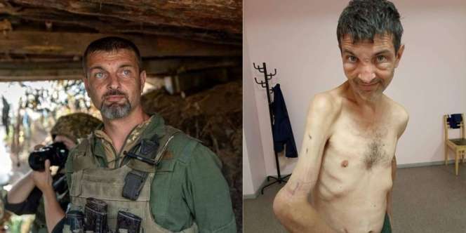 Viral Potret Diduga Tentara Ukraina dengan Badan Kurus Kering Usai Ditawan Rusia