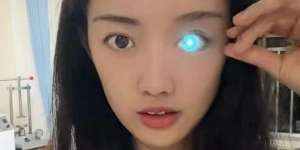 Buta karena Kecelakaan, Mata Wanita Ini Bisa Berubah Warna bak Robot