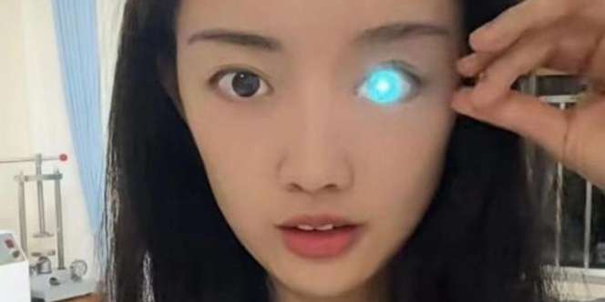 Buta karena Kecelakaan, Mata Wanita Ini Bisa Berubah Warna bak Robot