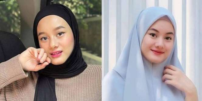 Deretan Seleb yang Disebut Oplas, Wajahnya Terlihat Beda!