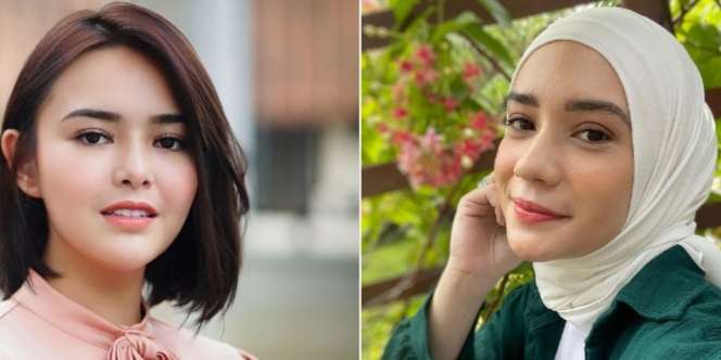 Hasil Perawatan Wajah Amanda Manopo dan Putri Anne Dibandingkan-bandingkan, Siapa Lebih Kece?